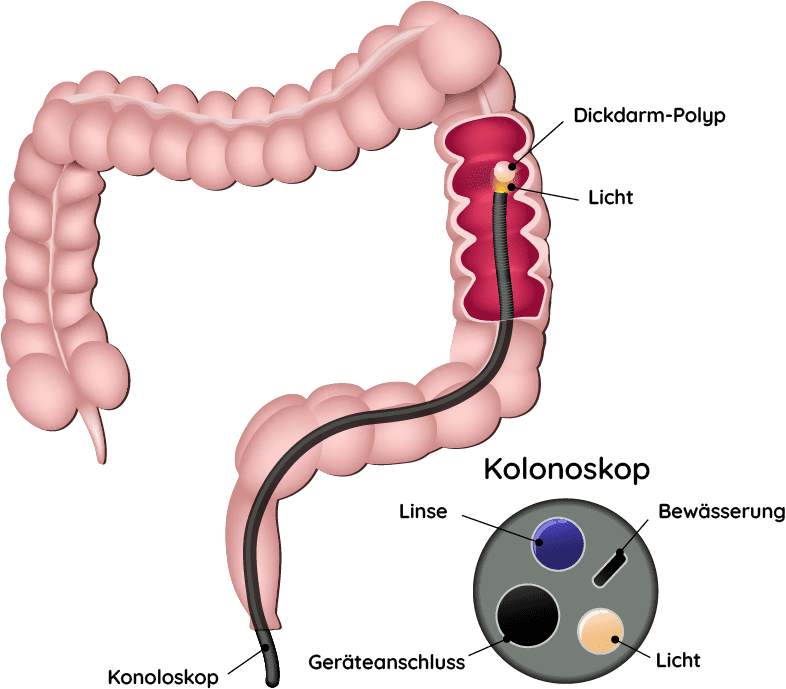 Koloskopie